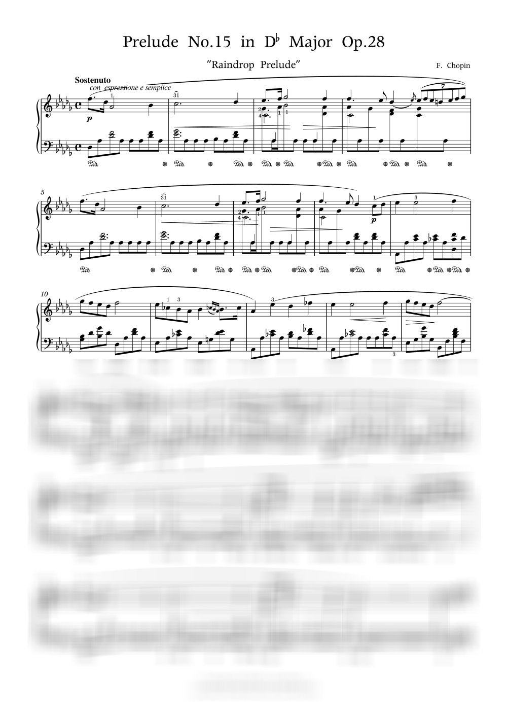 빗방울 전주곡 / 고급 - 쇼팽 (F. Chopin) by 피아노키위즈-0
